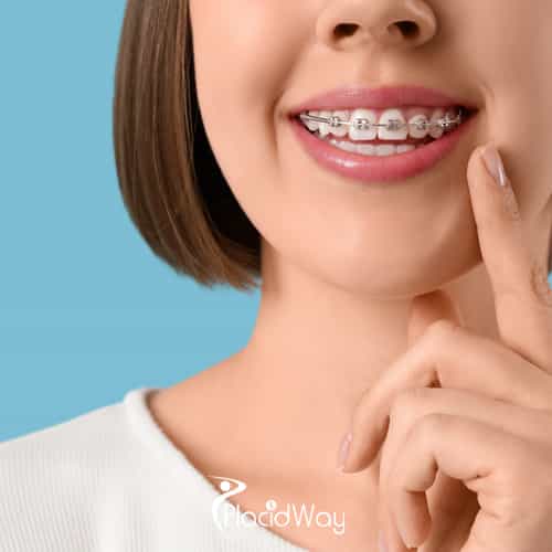 Clear Aligner Tourism: Why Bengaluru is Emerging as the Preferred Hub for Western Digital Nomads Seeking High-Tech Orthodontic Correction